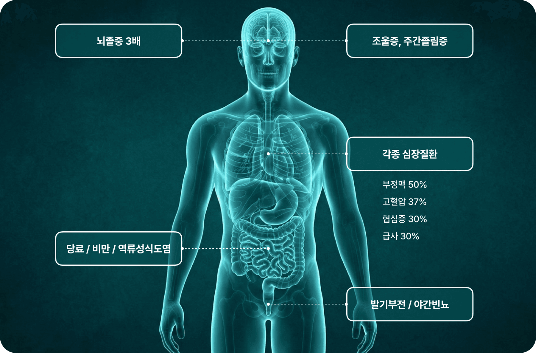 코골이·수면 무호흡증 합병증 — 뇌졸중 3배, 조울증, 주간졸림증, 각종 심장질환, 당뇨, 비만, 역류성식도염, 발기부전, 야간빈뇨