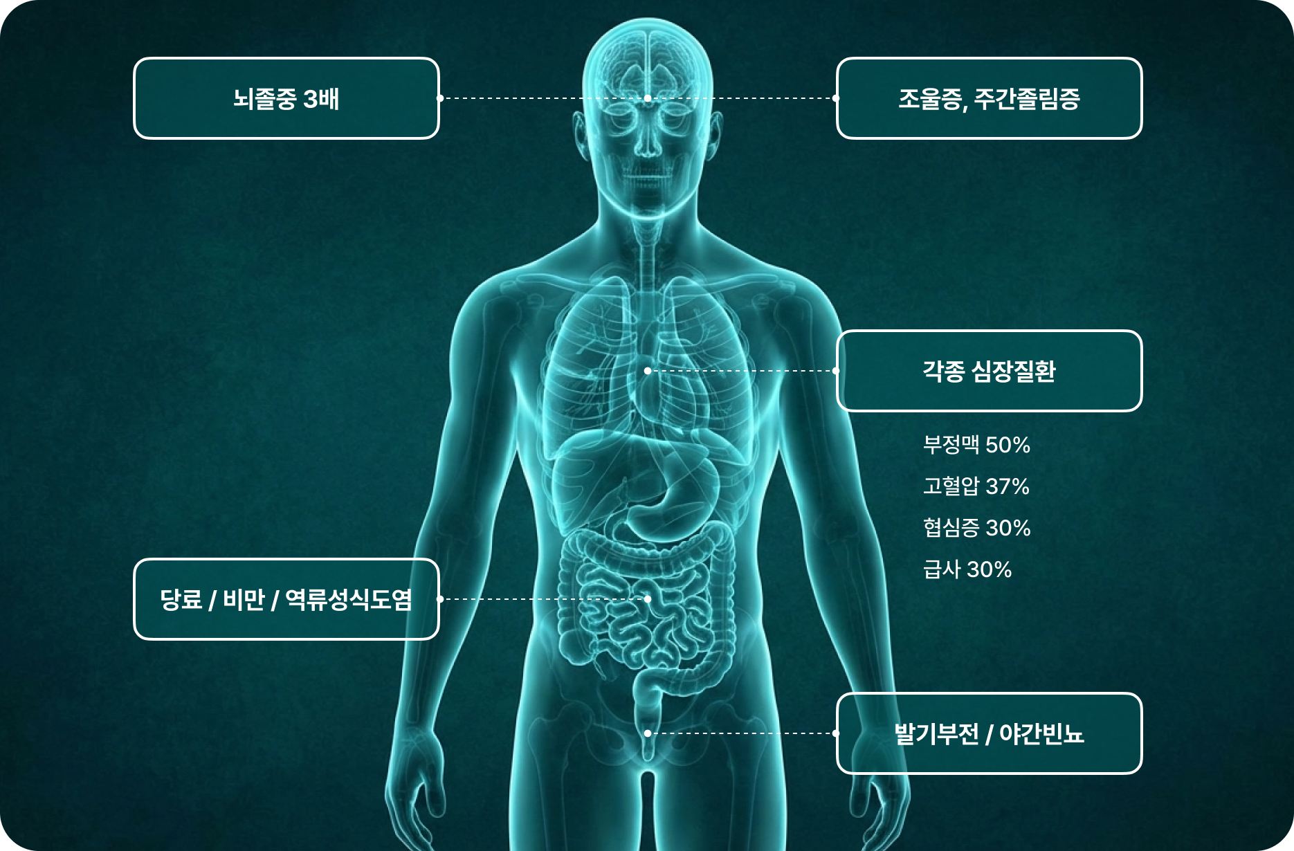 코골이·수면 무호흡증 합병증 — 뇌졸중 3배, 조울증, 주간졸림증, 각종 심장질환, 당뇨, 비만, 역류성식도염, 발기부전, 야간빈뇨
