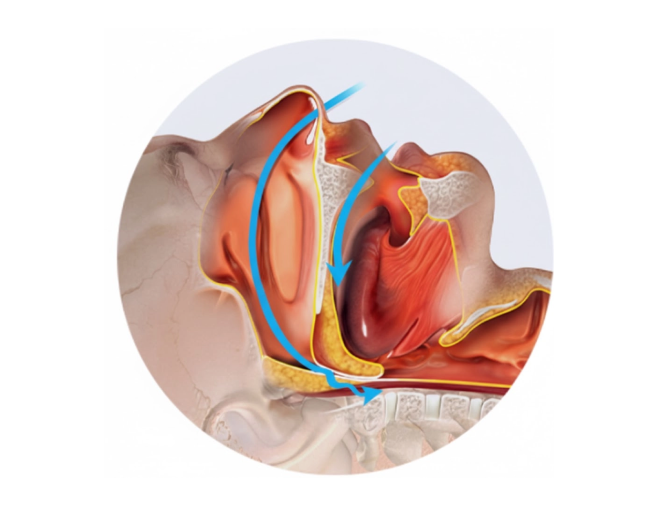 수면무호흡 기도 단면 일러스트